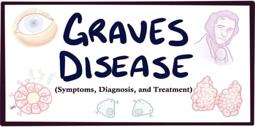 Graves’ disease (Symptoms, Diagnosis, and Treatment)