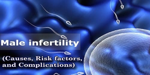 Male Infertility (Causes, Risk factors, and Complications)