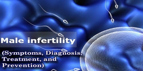 Male Infertility (Symptoms, Diagnosis, Treatment, and Prevention)