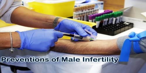 Male Infertility Symptoms Diagnosis Treatment And Prevention Zoefact 3216