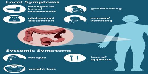 Colorectal Cancer (Symptoms, Diagnosis, Treatment) - Assignment Point