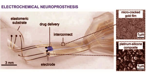 Neuroprosthetics – a discipline related to neuroscience