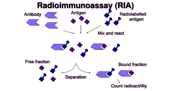 Radioimmunoassay – an Immunological Assay
