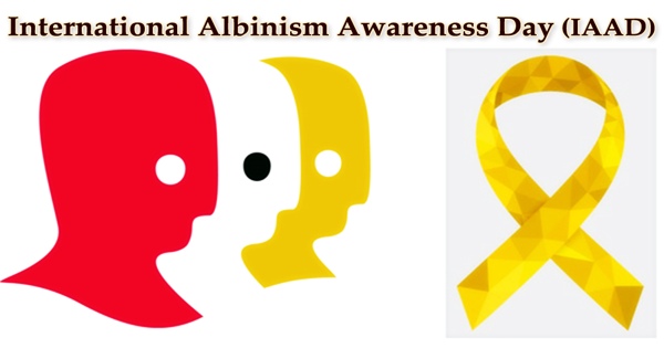 International Albinism Awareness Day (IAAD)