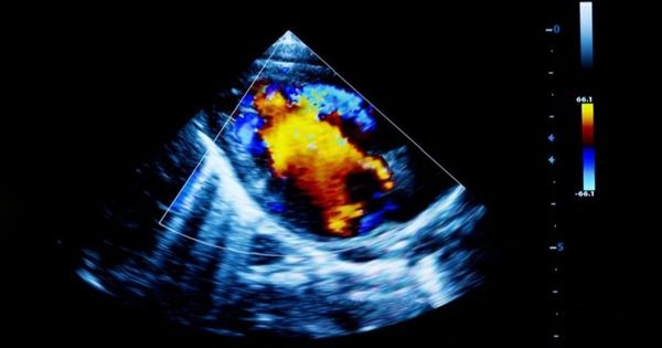 Researchers Demonstrated a New Technique for Creating Ultrasound Images