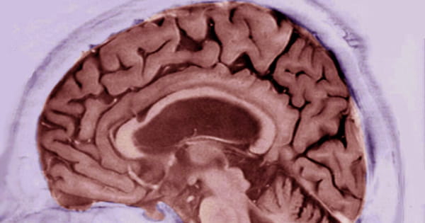 Dementia Test Results are Connected to Changes in Brain Structure