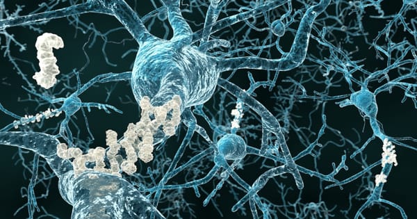 Inflammation of Brain Tissue is vital in the Progression of Alzheimer’s Disease