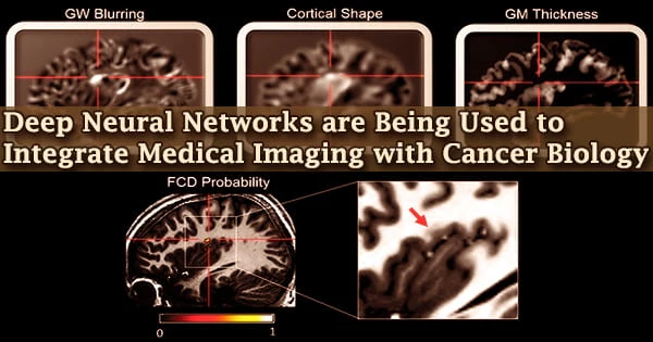 Deep Neural Networks are Being Used to Integrate Medical Imaging with Cancer Biology