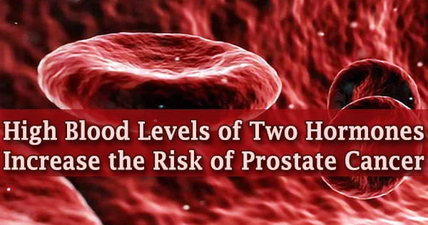 High Blood Levels of Two Hormones Increase the Risk of Prostate Cancer