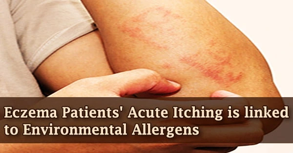Eczema Patients’ Acute Itching is linked to Environmental Allergens