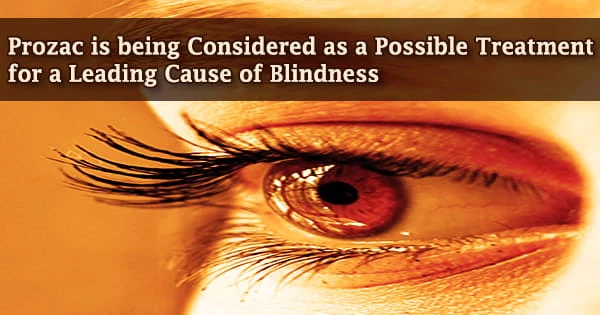 Prozac is being Considered as a Possible Treatment for a Leading Cause of Blindness
