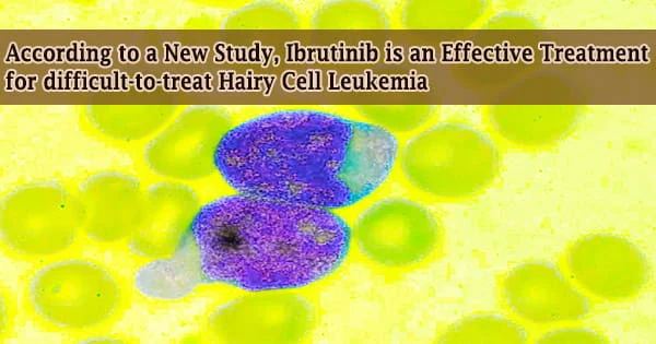 According to a New Study, Ibrutinib is an Effective Treatment for difficult-to-treat Hairy Cell Leukemia