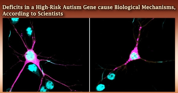 Deficits in a High-Risk Autism Gene cause Biological Mechanisms, According to Scientists