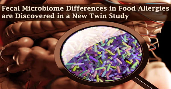 Fecal Microbiome Differences in Food Allergies are Discovered in a New Twin Study