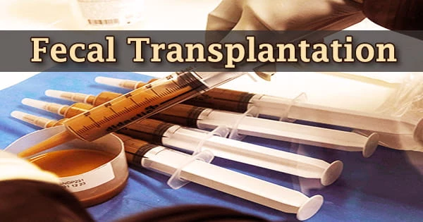 Fecal Transplantation