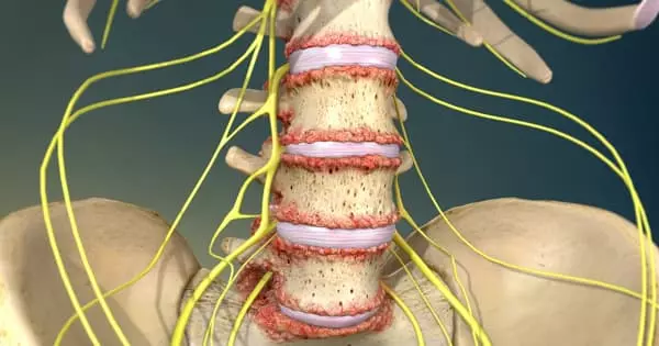 Lower Back Pain and Damage to Soft Tissues