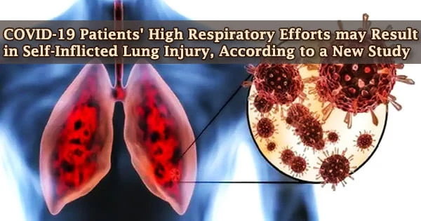 COVID-19 Patients’ High Respiratory Efforts may Result in Self-Inflicted Lung Injury, According to a New Study