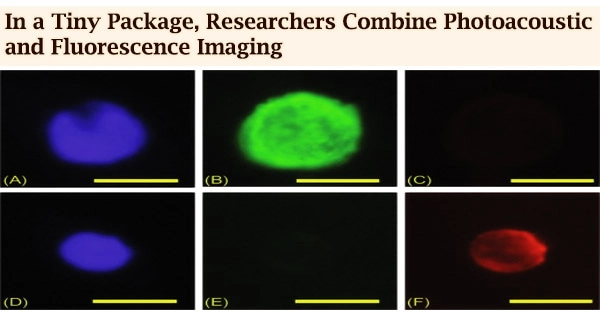 In a Tiny Package, Researchers Combine Photoacoustic and Fluorescence Imaging