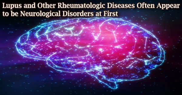 Lupus and Other Rheumatologic Diseases Often Appear to be Neurological Disorders at First