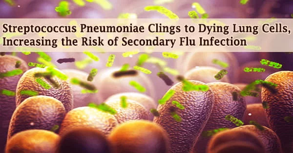 Streptococcus Pneumoniae Clings to Dying Lung Cells, Increasing the Risk of Secondary Flu Infection