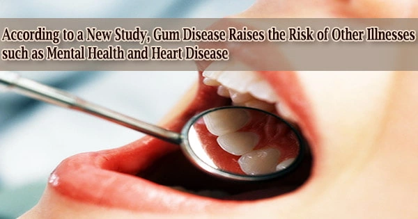 According to a New Study, Gum Disease Raises the Risk of Other Illnesses such as Mental Health and Heart Disease