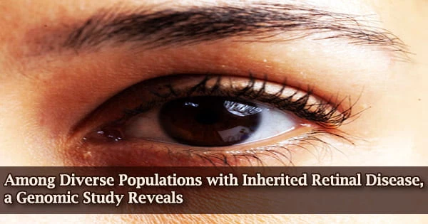Among Diverse Populations with Inherited Retinal Disease, a Genomic Study Reveals