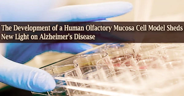 The Development of a Human Olfactory Mucosa Cell Model Sheds New Light on Alzheimer’s Disease
