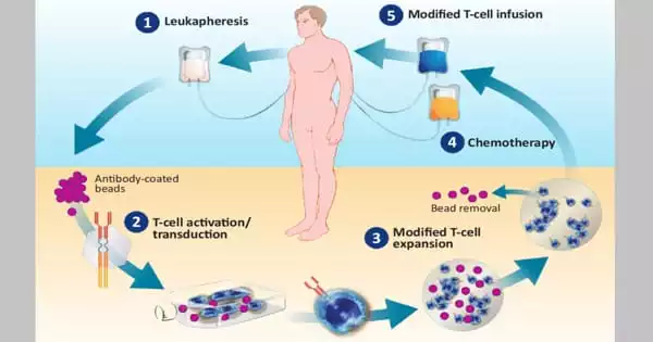 CAR T Cell Treatment Manufacturing Time is Reduced by Researchers