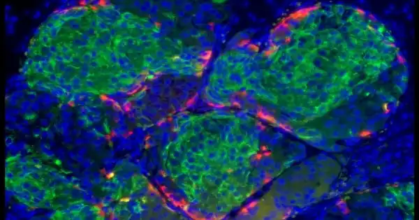 In Diabetes, a New Method Developed to Protect Insulin-producing Cells