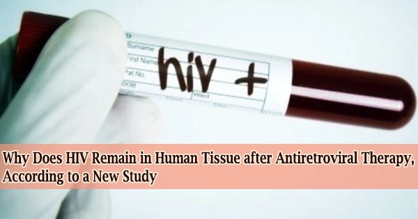 Why Does HIV Remain in Human Tissue after Antiretroviral Therapy, According to a New Study
