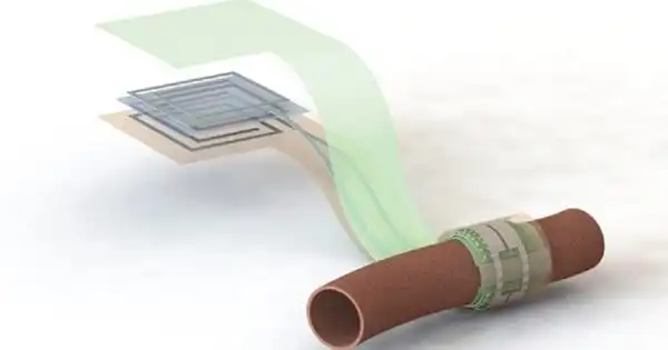 Wireless Implanted Vascular Monitoring System developed by Researchers