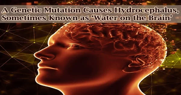 A Genetic Mutation Causes Hydrocephalus, Sometimes Known as ‘Water on the Brain’