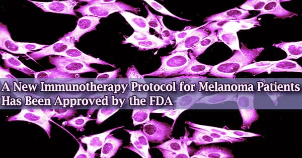 A New Immunotherapy Protocol for Melanoma Patients Has Been Approved by the FDA