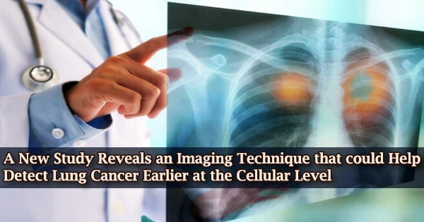 A New Study Reveals an Imaging Technique that could Help Detect Lung Cancer Earlier at the Cellular Level
