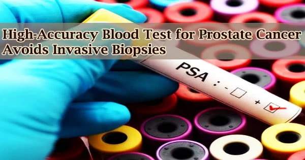 High-Accuracy Blood Test for Prostate Cancer Avoids Invasive Biopsies
