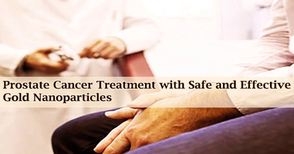 Prostate Cancer Treatment with Safe and Effective Gold Nanoparticles