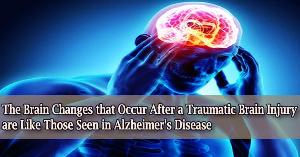The Brain Changes that Occur After a Traumatic Brain Injury are Like Those Seen in Alzheimer’s Disease