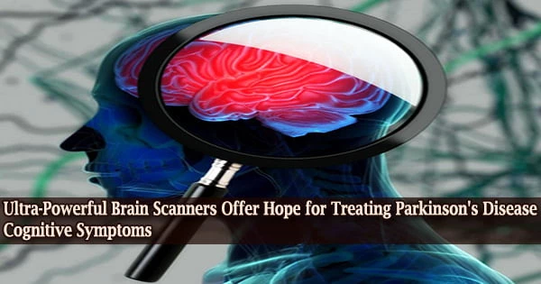 Ultra-Powerful Brain Scanners Offer Hope for Treating Parkinson’s Disease Cognitive Symptoms