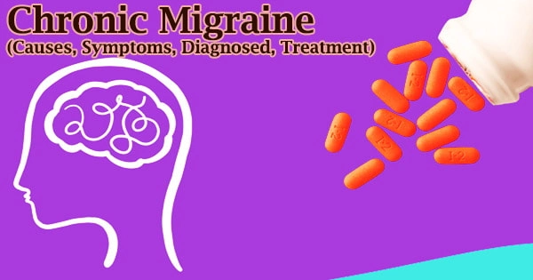 Chronic Migraine (Causes, Symptoms, Diagnosed, Treatment)