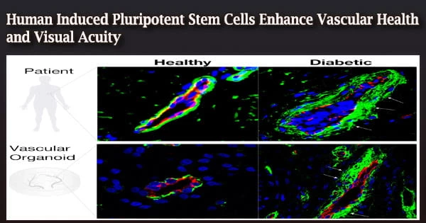 Human Induced Pluripotent Stem Cells Enhance Vascular Health and Visual Acuity