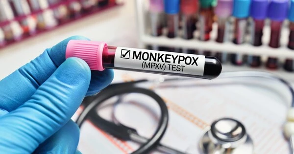 World Health Organization has declared Monkeypox a Global Emergency