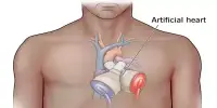 A Significant Step forward in the Creation of Human-sized Artificial Heart