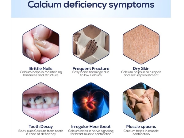 Calcium-Deficiency-1