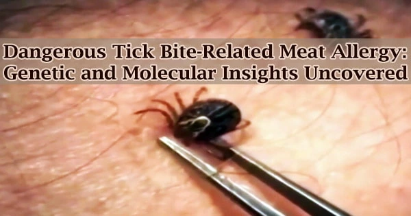 Dangerous Tick Bite-Related Meat Allergy: Genetic and Molecular Insights Uncovered