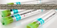 Study Finds that Saliva, Semen, and Other Clinical Samples from Infected Patients Frequently Detect Monkeypox Virus