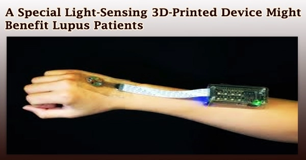A Special Light-Sensing 3D-Printed Device Might Benefit Lupus Patients