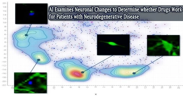 AI Examines Neuronal Changes to Determine whether Drugs Work for Patients with Neurodegenerative Disease