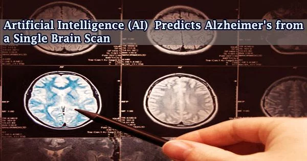 Artificial Intelligence (AI) Predicts Alzheimer’s from a Single Brain Scan