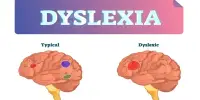 Dyslexia – reading disorder