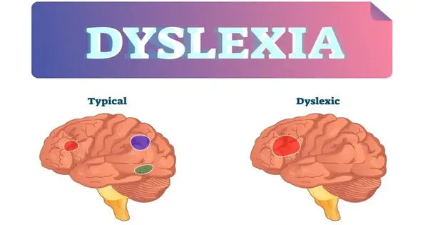 Dyslexia – reading disorder